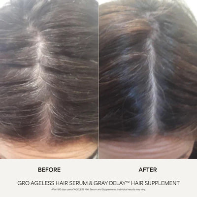 GRO AGELESS Gray Delay™ Hair Supplement (3 Pack)