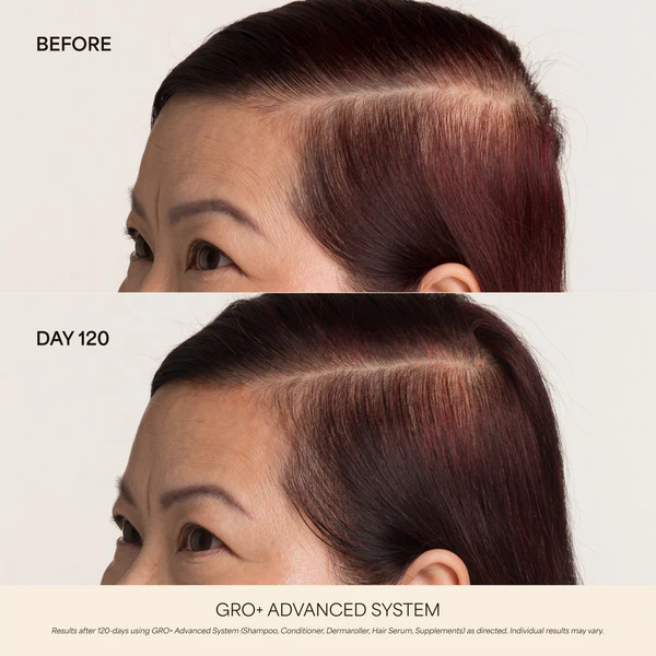 GRO+ Advanced Essentials Kit